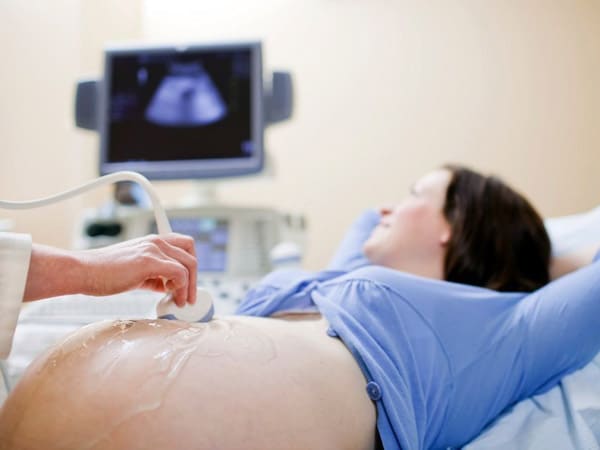 Visualizzare-feto-su-monitor